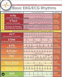 basic ecg rhythms